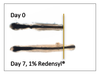 Redensyl - the hair growth galvanizer